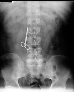 Ht x ray scissors ss jp 111212 ssv