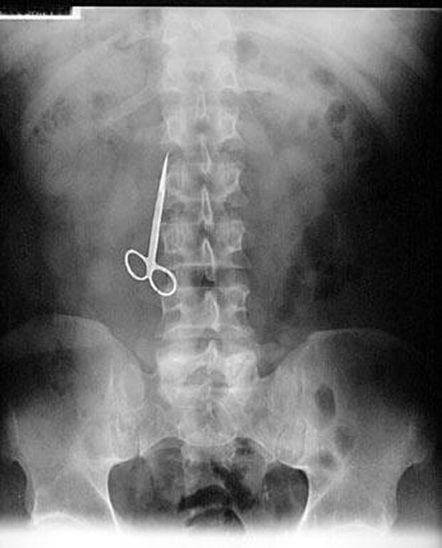 Ht x ray scissors ss jp 111212 ssv